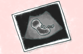 ultrasound
